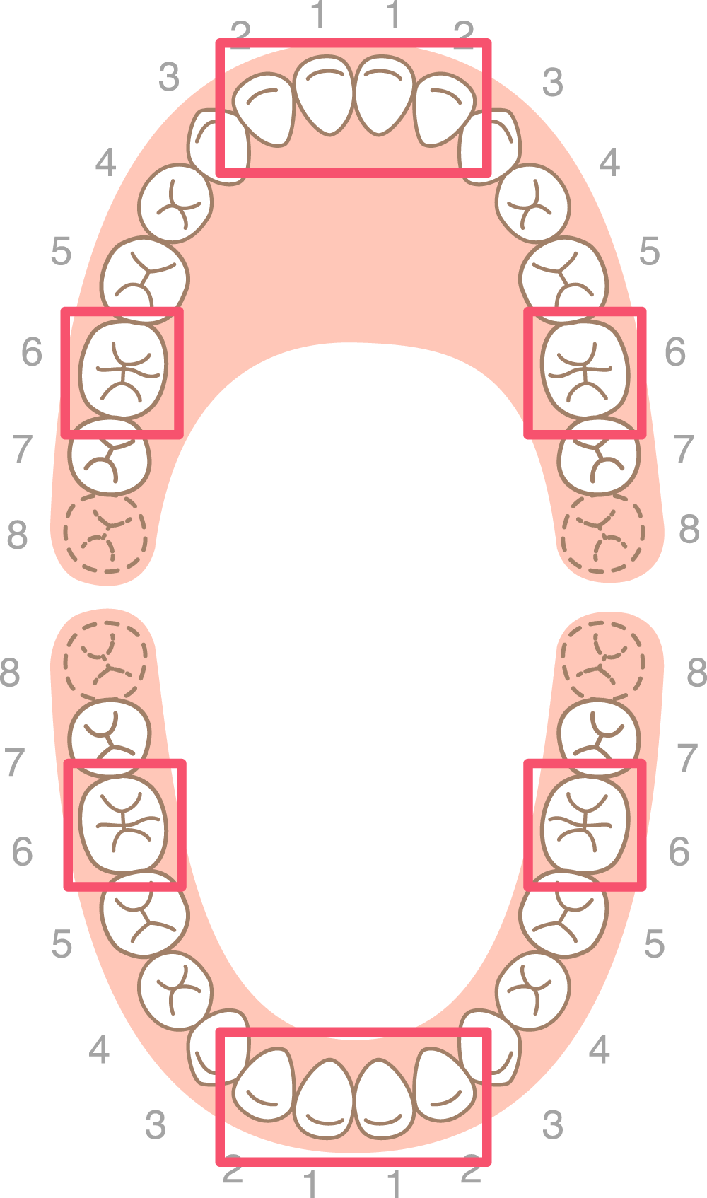子どもの矯正に適したタイミングは？
